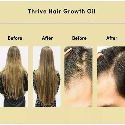 Natural Hair Growth Serum